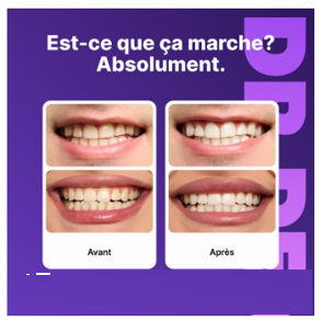Teeth Whitening Strips (box1)