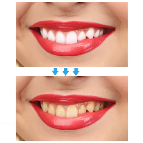 Teeth Whitening Strips (box1)