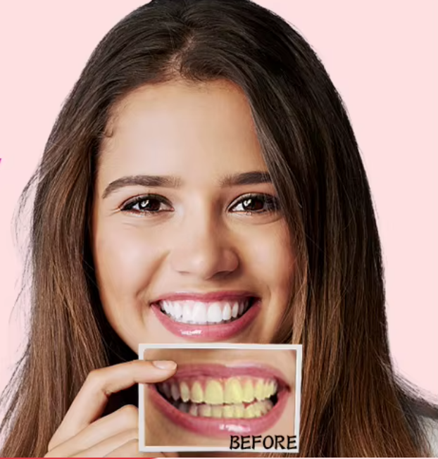Teeth Whitening Strips (box1)
