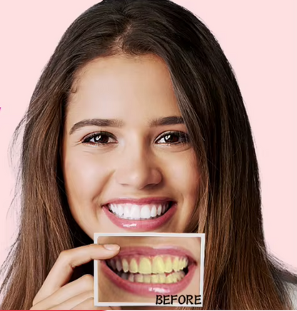 Teeth Whitening Strips (box1)