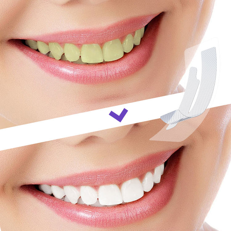 Teeth Whitening Strips (box1)